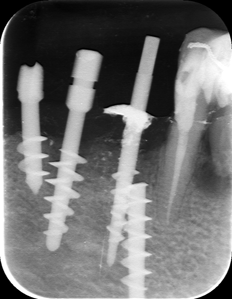 Un uso speciale per un impianto di Garbaccio.